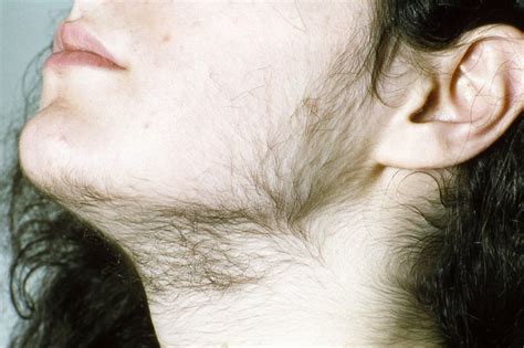 atk hairy teen pics|The Beauty of Hirsutism 18+ (@happilyhirsute) .